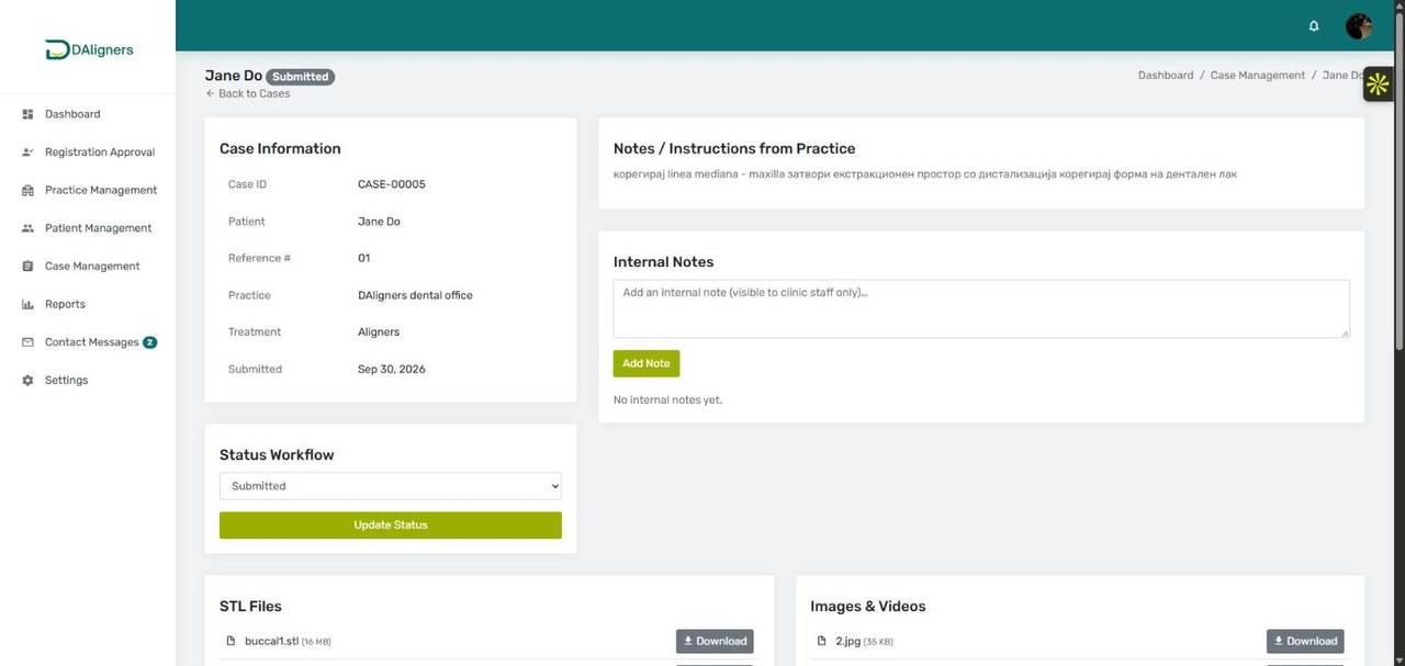 DAligners admin portal case details page with STL file downloads and status workflow for aligner production