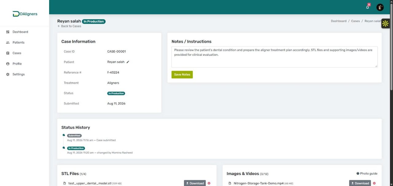 DAligners clinic portal case details page showing STL files, status history and treatment notes